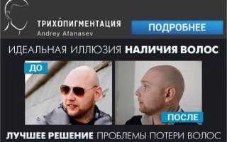 Что такое миноксидил