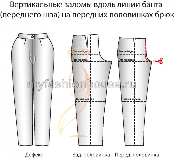 Дефекты брюк14. Вертикальные заломы вдоль линии банта